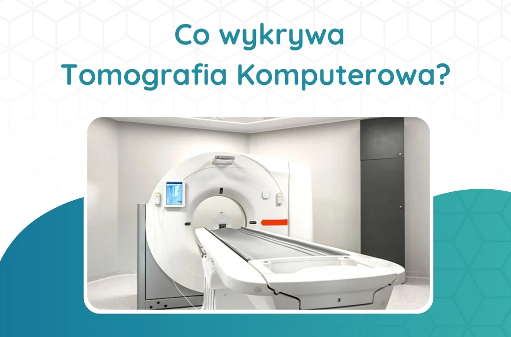 Co wykrywa Tomografia Komputerowa