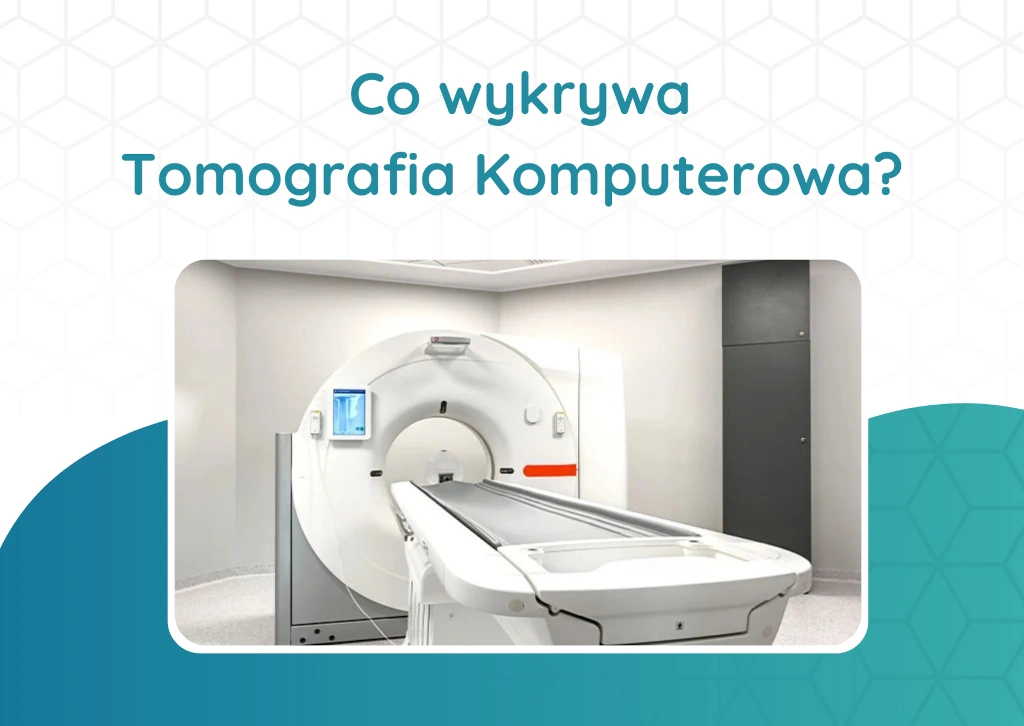 Co wykrywa tomografia komputerowa?