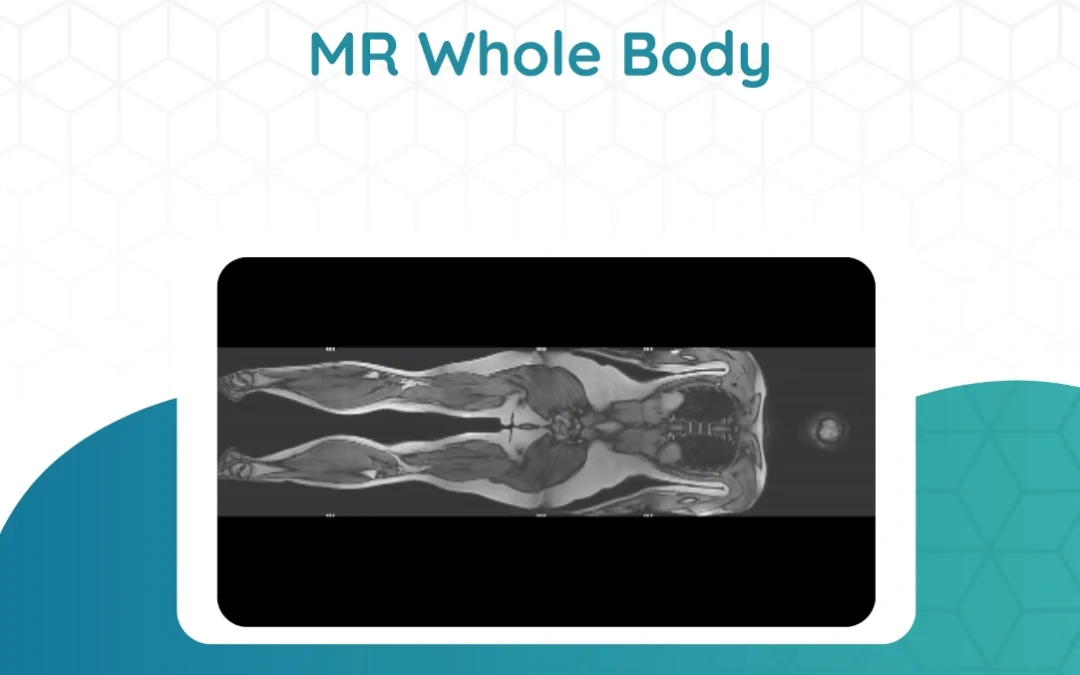 Rezonans magnetyczny całego ciała – MR whole body – co to za badanie?