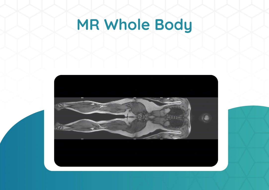 mr_whole_body rezonans magnetyczny całego ciała - mr whole body